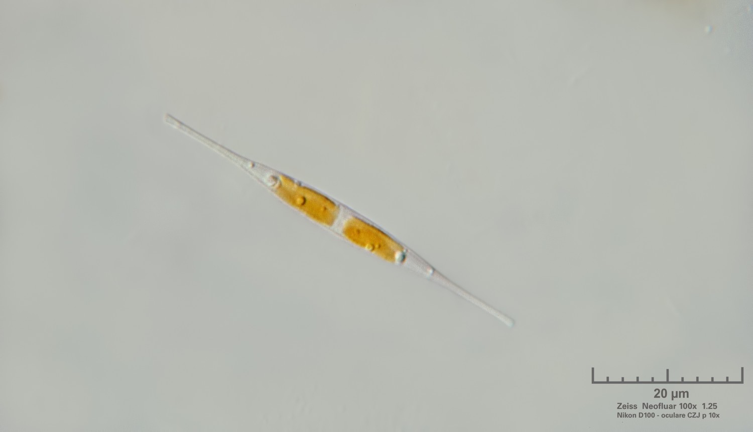 Nitzschia